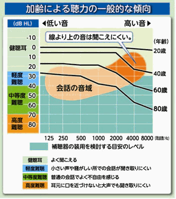 加齢による聴力の一般的な傾向